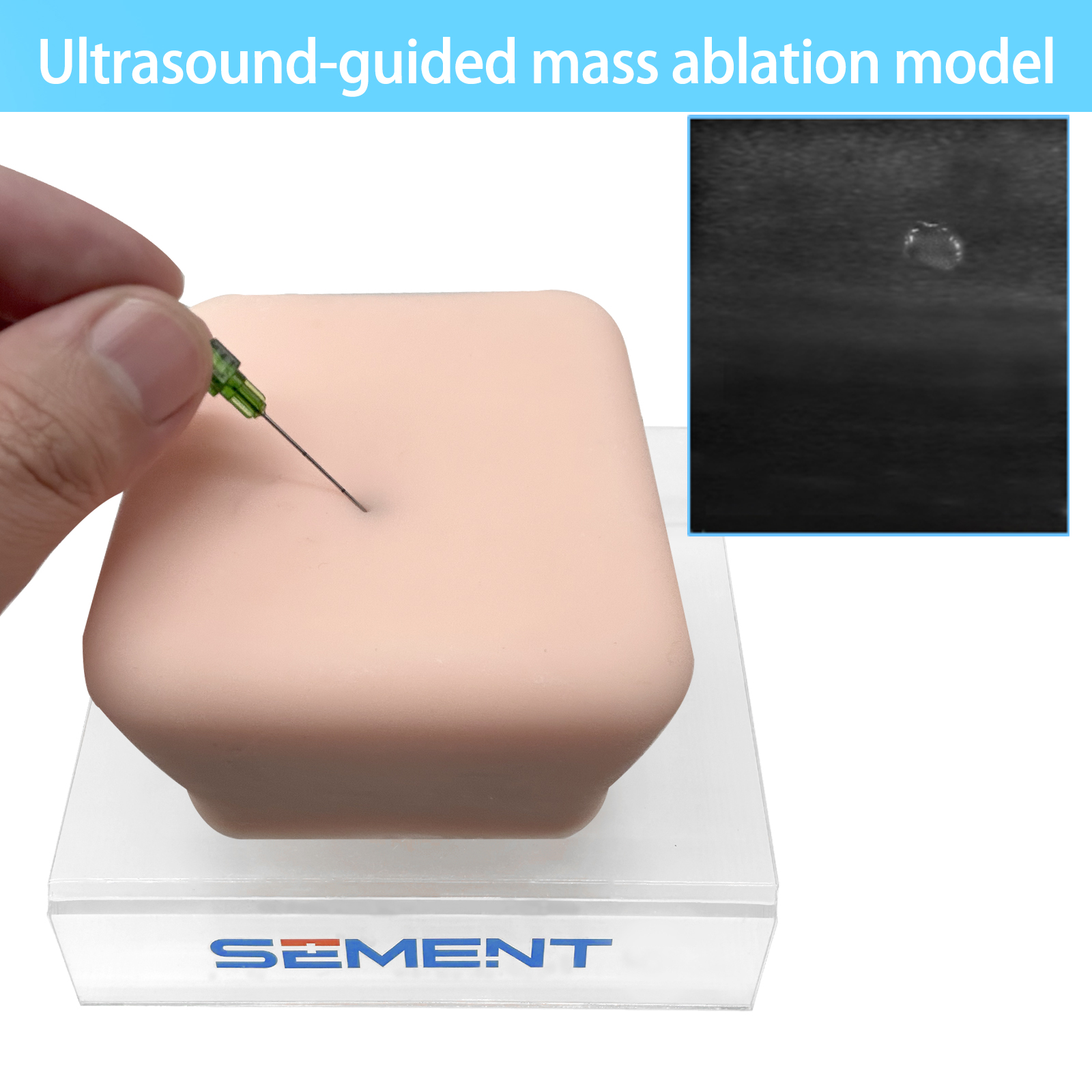 Ultrasound guided tumor ablati - огляд і ціна Medical Lab Ultrasound